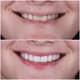Slider image (5) Odonto Liuzzi - Dental Clinic in Rio de Janeiro, Brazil
